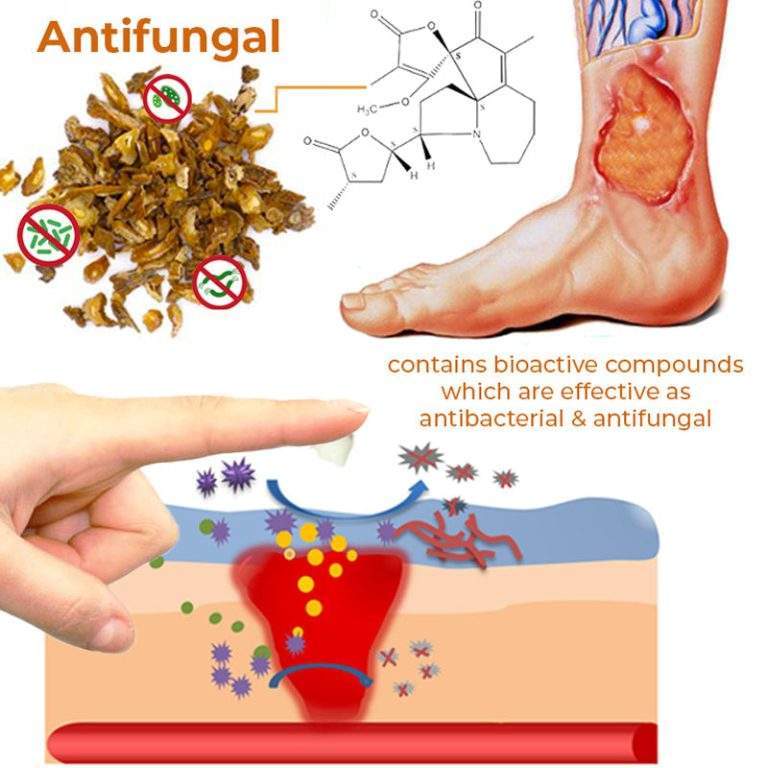 Bed Sore Treatment Cream Chyhua